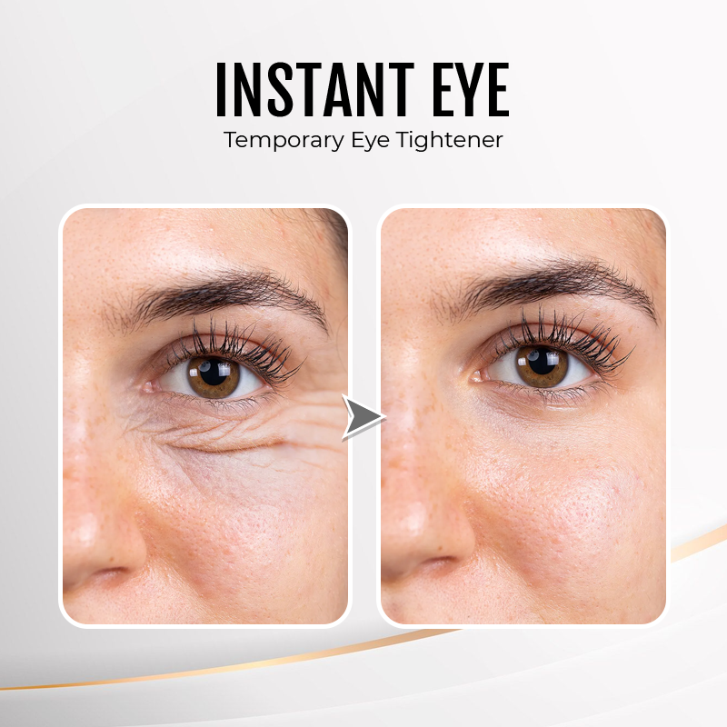 🎉Last Day Discount: 87% OFF💐Instant Wrinkle Eye Tightener cream-Best Selling🎉