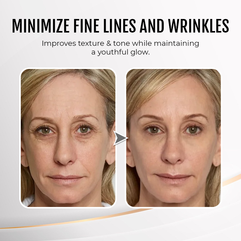 🎉Last Day Discount: 87% OFF💐Instant Wrinkle Eye Tightener cream-Best Selling🎉