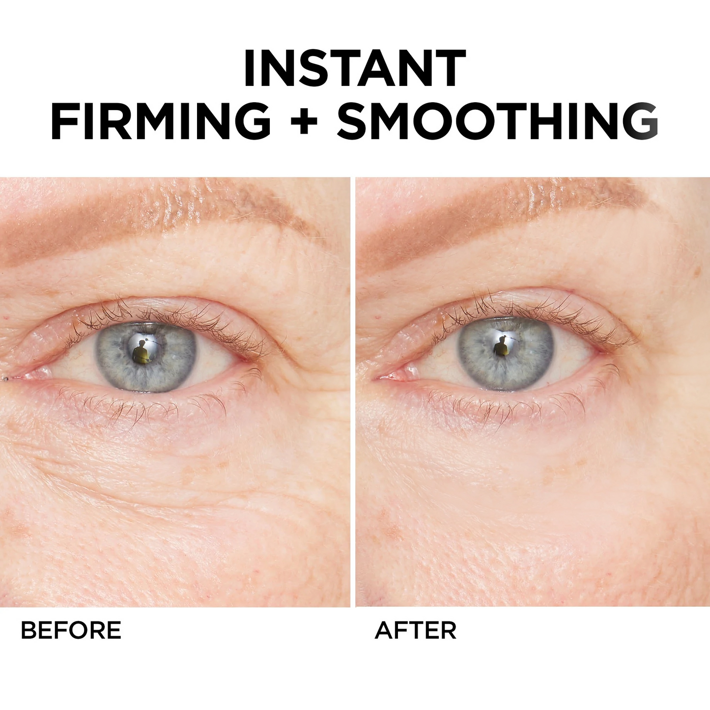 🎉Last Day Discount: 87% OFF💐Instant Wrinkle Eye Tightener cream-Best Selling🎉