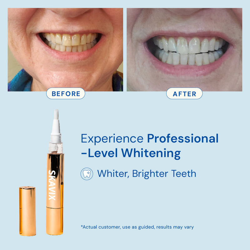 💖Extra-Strength Teeth Whitening Serum Pen + Dual-Peroxide Formula & Xylitol