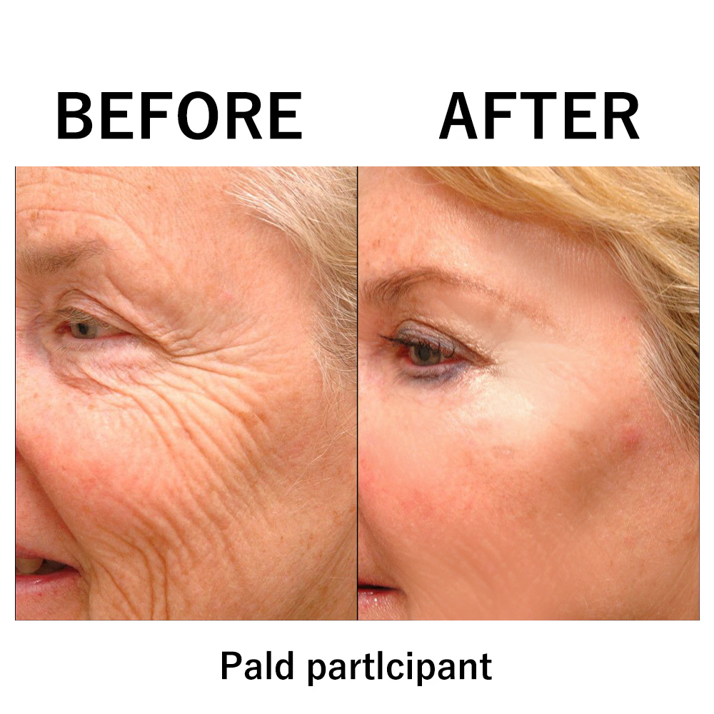 đ„ăOfficial Brand StoreăInstant FIRMx Temporary Face Tightenerâ 87% OFF!