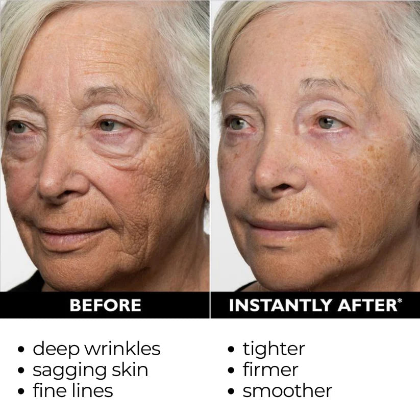 đ„ăOfficial Brand StoreăInstant FIRMx Temporary Face Tightenerâ 87% OFF!