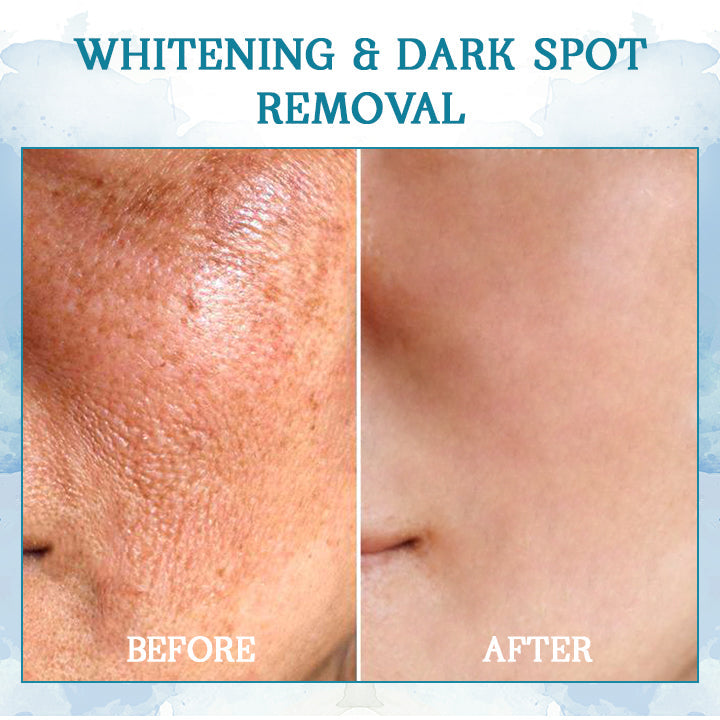 DIYSTAR™ LuxeLift Skin Firming Youth Butter🔥Best-Selling🔥🔥