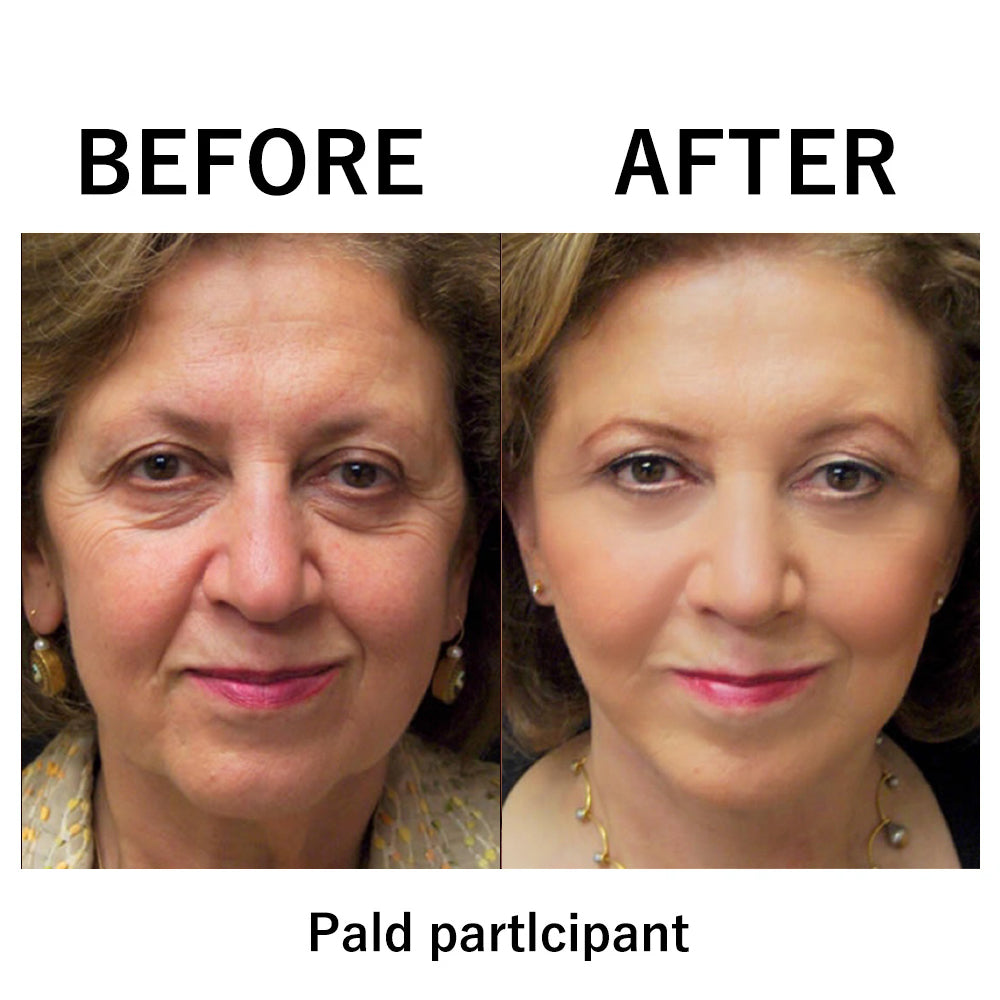 đ„ăOfficial Brand StoreăInstant FIRMx Temporary Face Tightenerâ 87% OFF!