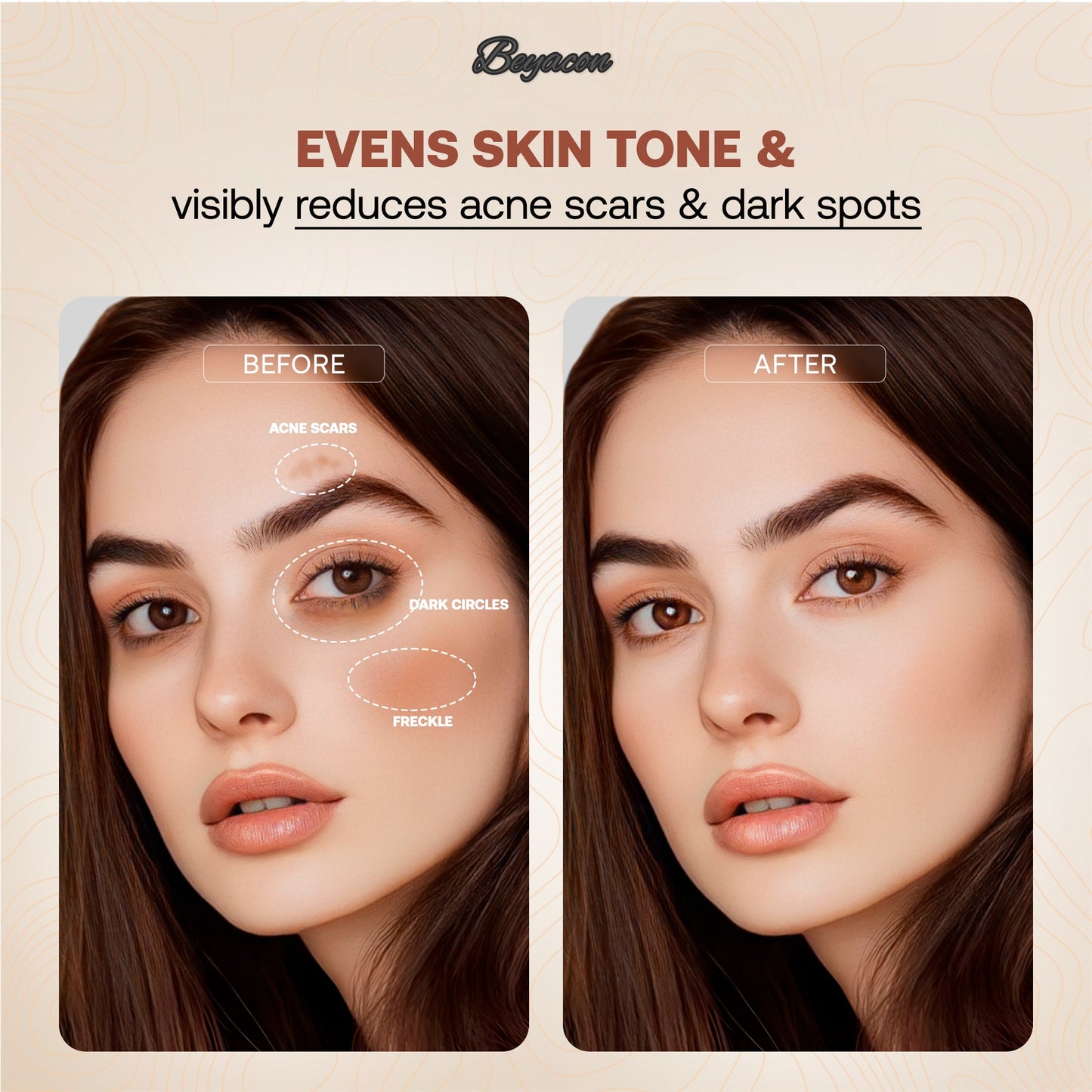 ⏰Last 3 hours - 60%🔥Beyacon® Serum Boosted Skin Tint Balm
