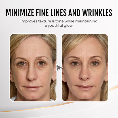 🎉Last Day Discount: 87% OFF💐Instant Wrinkle Eye Tightener cream-Best Selling🎉