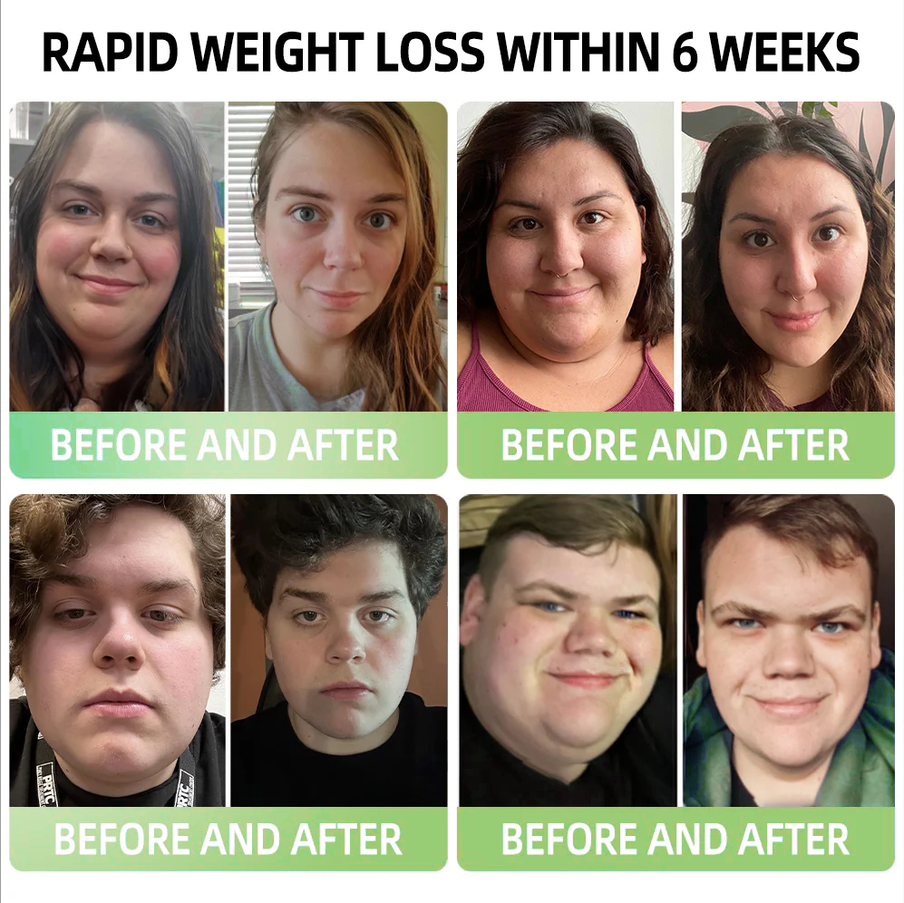 𝐇𝐚𝐫𝐯𝐚𝐫𝐝 𝐌𝐞𝐝𝐢𝐜𝐚𝐥 𝐒𝐜𝐡𝐨𝐨𝐥 𝐑𝐞𝐜𝐨𝐦𝐦𝐞𝐧𝐝𝐞𝐝 | Cvreoz® GLP-1 Slimming & Health Boost Drops 2.0（🏆Powerful GLP-1 Fat Burner |  ✅addressing diabetes, obesity, and cardiovascular diseases| ✅Natural Weight Loss & Energy Balance）🌞