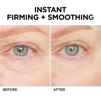 🎉Last Day Discount: 87% OFF💐Instant Wrinkle Eye Tightener cream-Best Selling🎉