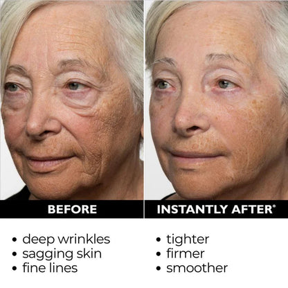 🔥【Official Brand Store】Instant FIRMx Temporary Face Tightener– 87% OFF!