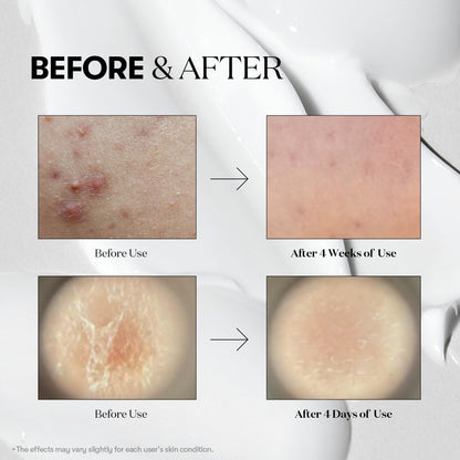 🔥 Last Day 60% OFF! ✨ VT Cica Reedle Shot 50/100/300/700 – At-Home Microneedling Serum | Glow, Tighten & Repair