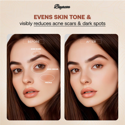 ⏰Last 3 hours - 60%🔥Beyacon® Serum Boosted Skin Tint Balm