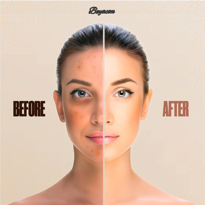 ⏰Last 3 hours - 60%🔥Beyacon® Serum Boosted Skin Tint Balm