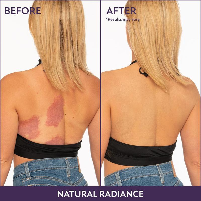 🎉Last Day 70% Off🎁 - All Over Complexion Perfector