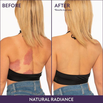 🎉Last Day 70% Off🎁 - All Over Complexion Perfector