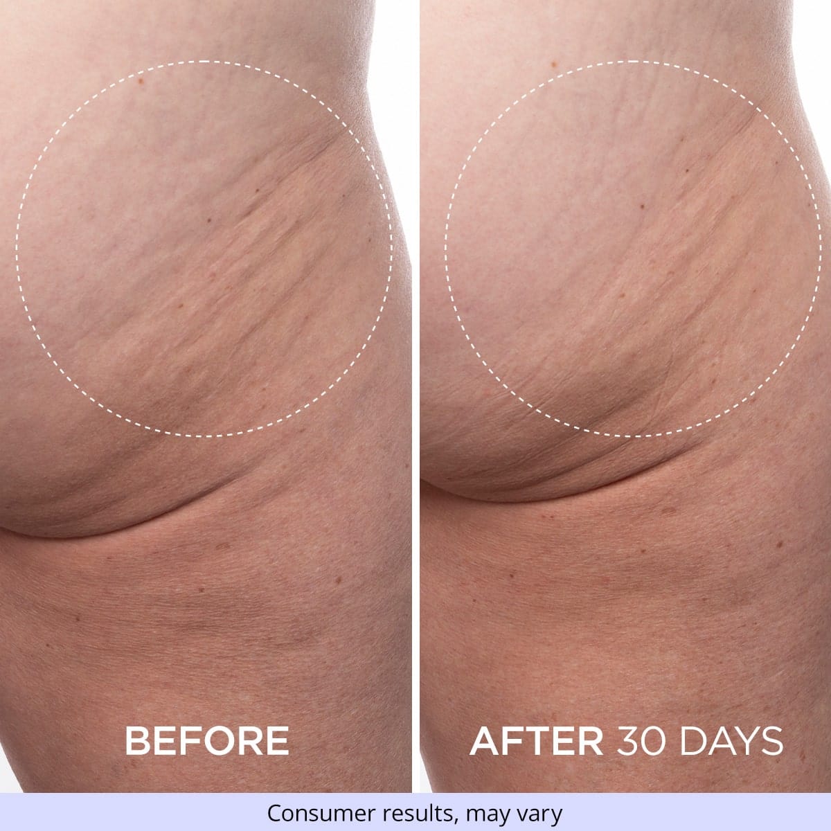 Firming Butt & Thigh Cream