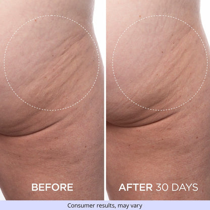Firming Butt & Thigh Cream